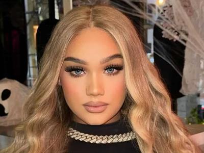 Atacan a tiros a urbana Masha en la 27 de Febrero; una joven muere