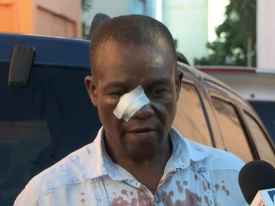 Profesor denuncia agresión de estudiantes en liceo Juan Pablo Duarte