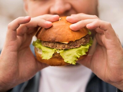 Día Mundial de la Obesidad: alertan sobre avance “silencioso” en RD