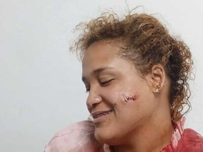 Violencia de género: mujer es agredida por su pareja en Puerto Plata