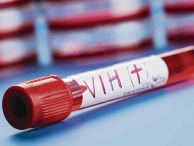 Caída de ayuda internacional pone en peligro la lucha contra el VIH